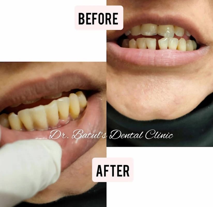 results-dental-drbatulsclinic-bizknow.in-2