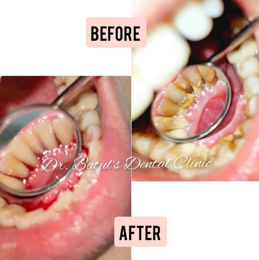 results-dental-drbatulsclinic-bizknow.in-4