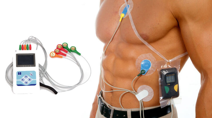 Holter Monitoring