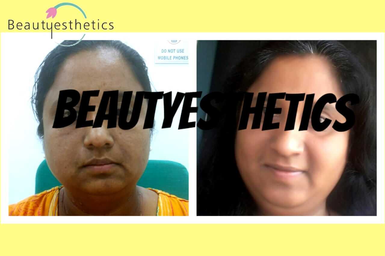 results-drpriyaparekh-beautyesthetics-bizknow.in-5