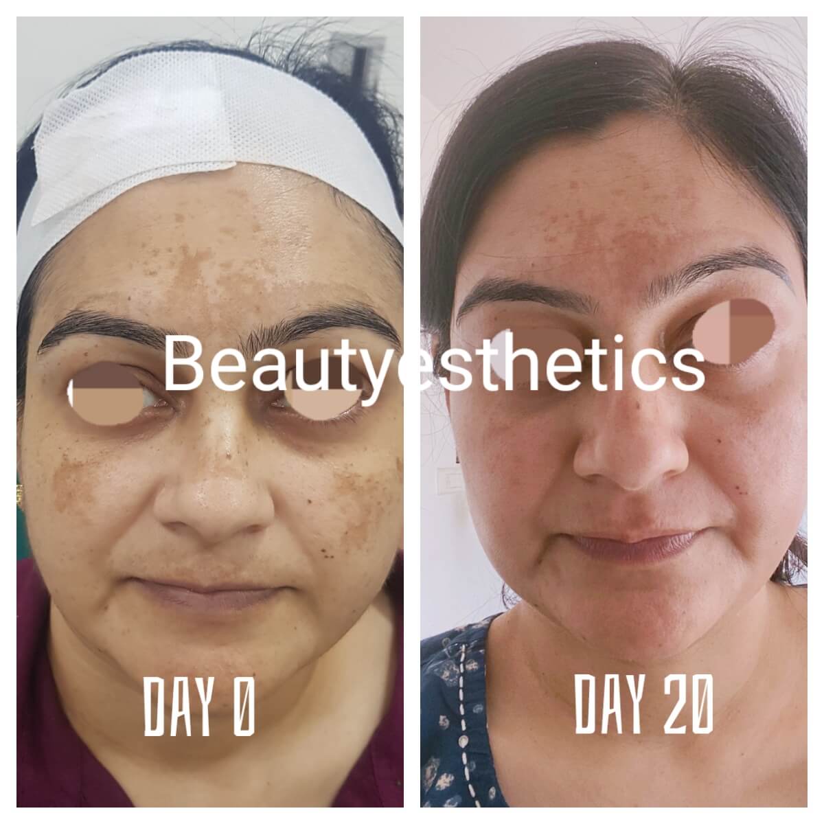 results-drpriyaparekh-beautyesthetics-bizknow.in-6