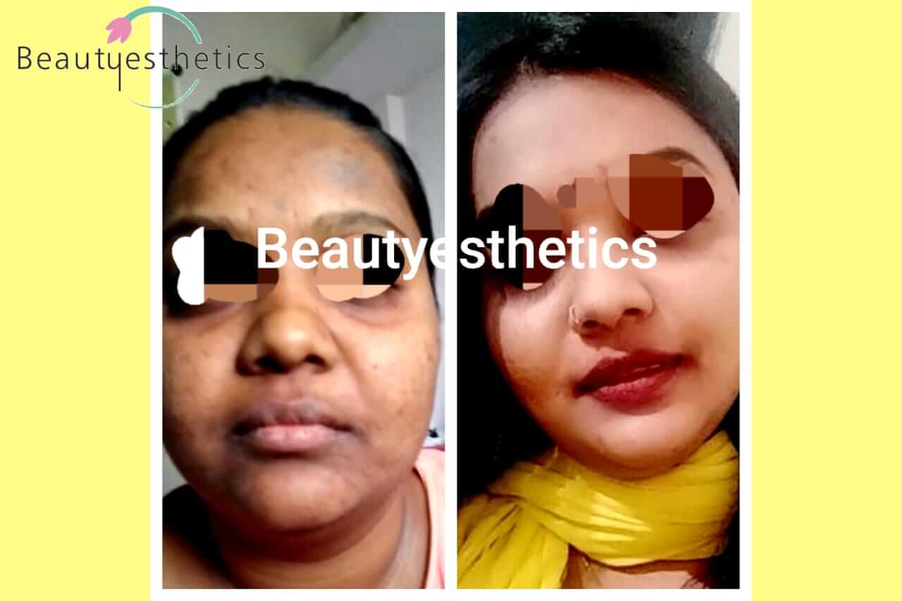 results-drpriyaparekh-beautyesthetics-bizknow.in-7