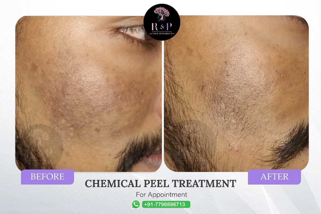 results-skintreatment-drrashmiaderao-bizknow.in-2