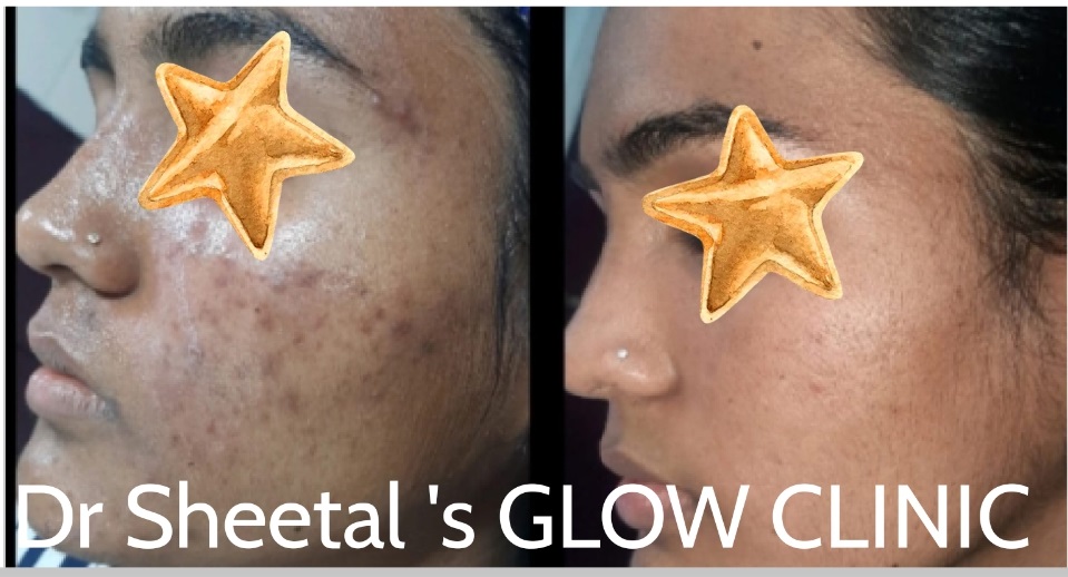 results-drsheetalsglowskinclinic-bizknow.in-1