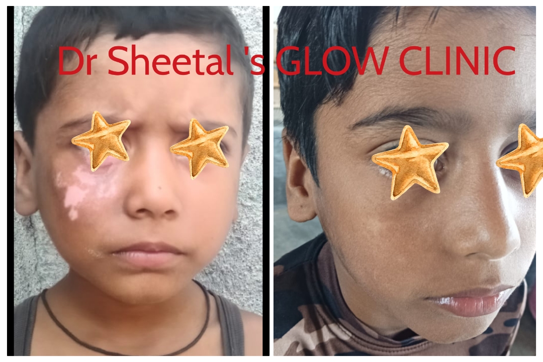 results-drsheetalsglowskinclinic-bizknow.in-5