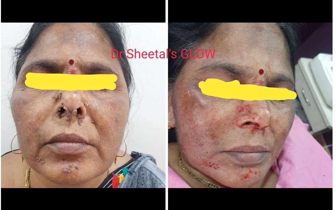 results-drsheetalsglowskinclinic-bizknow.in-6