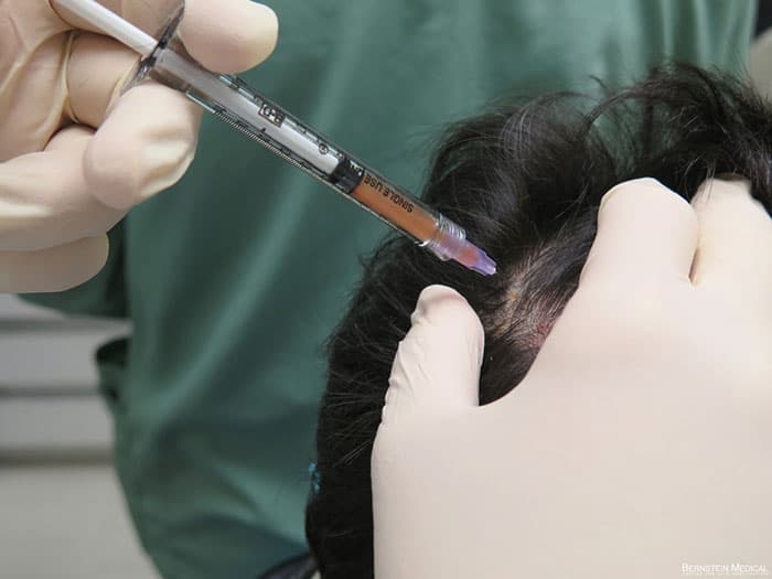 hair-treatment-clinic-in-wakad
