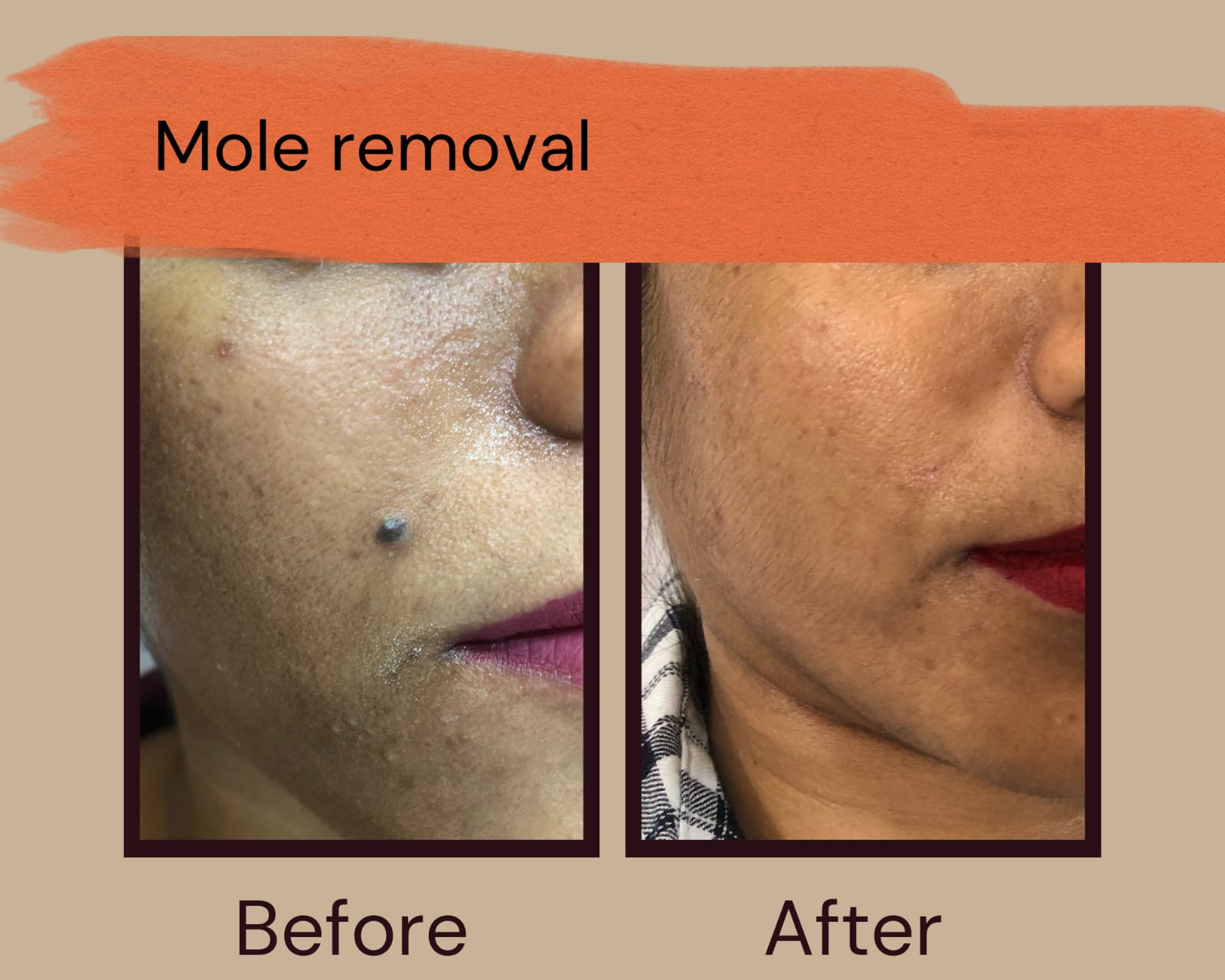results-skinclinic360-bizknow.in-3