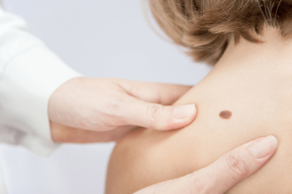 skin treatment in pimple saudagar