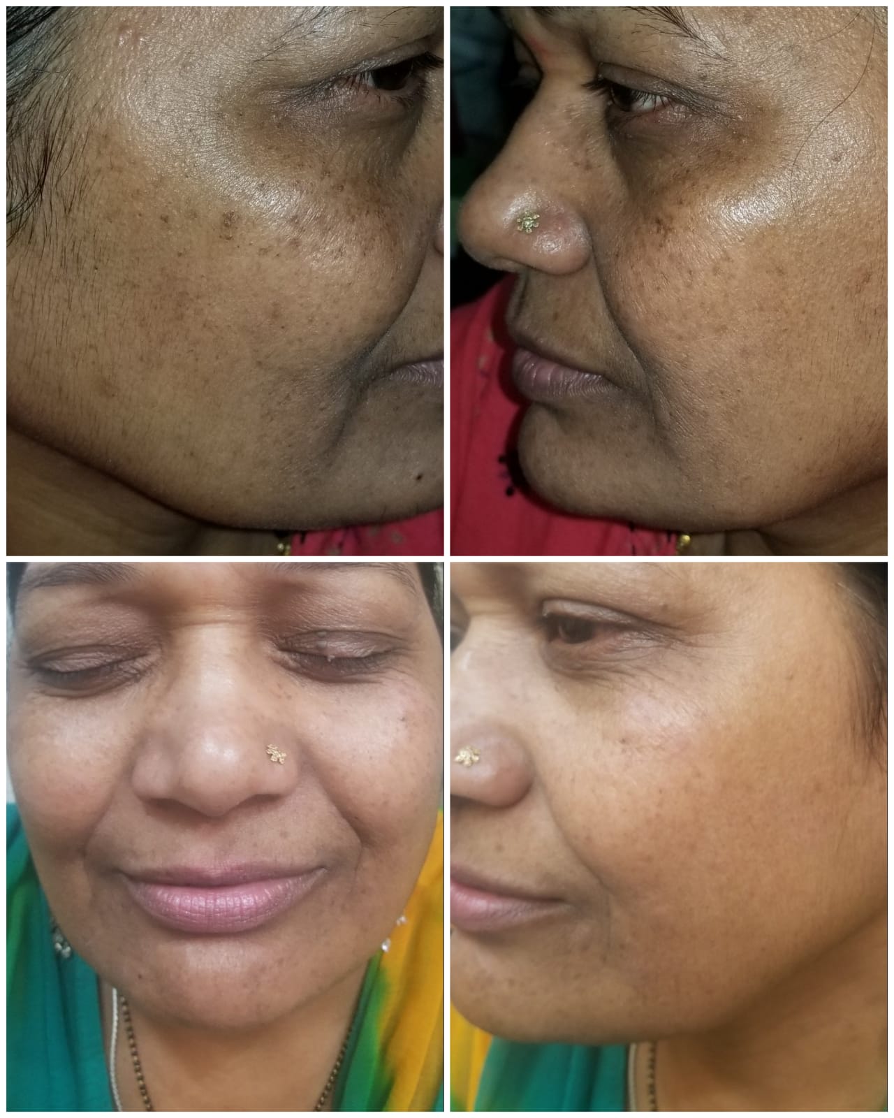 results-sparshskinclinic-bizknow.in-1
