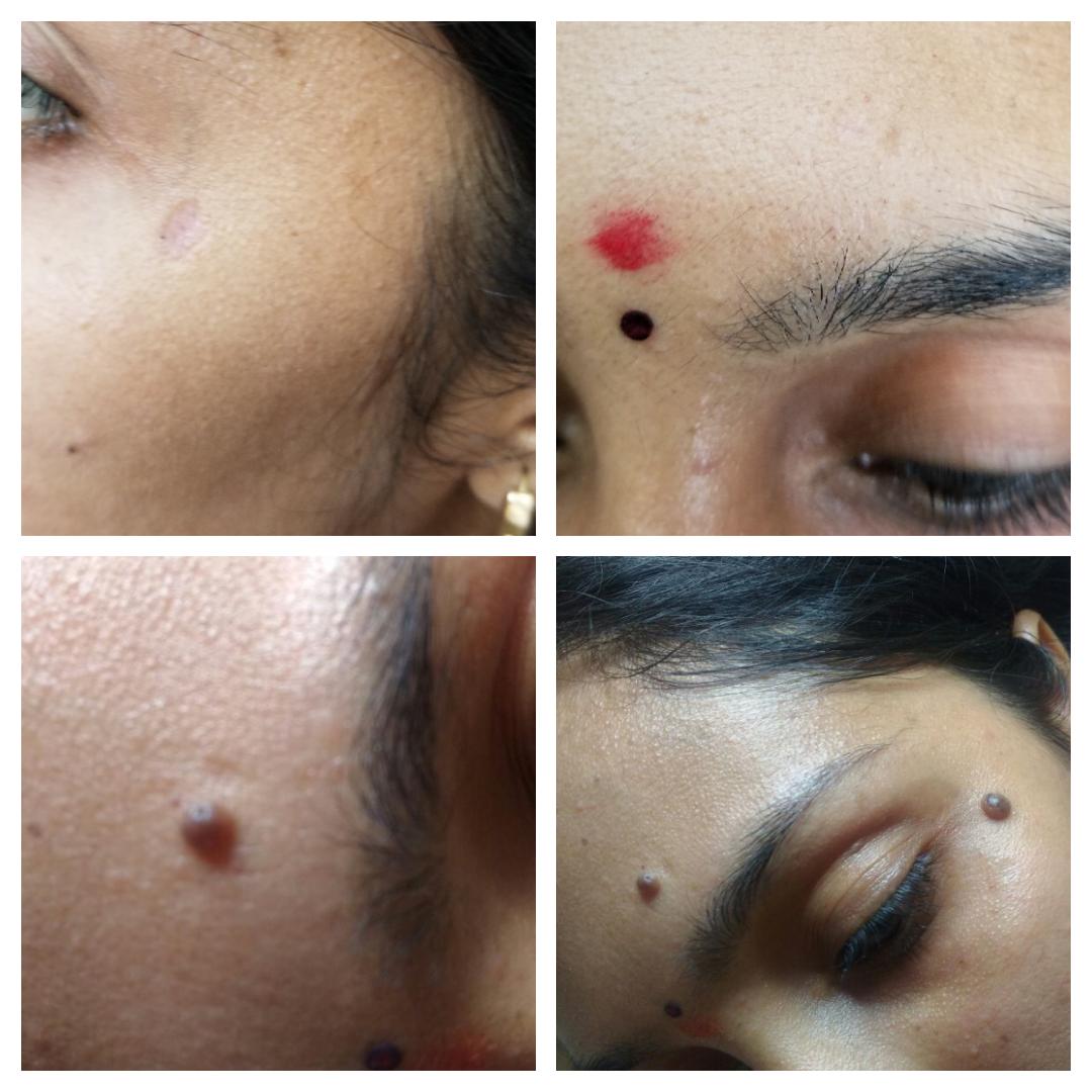 results-sparshskinclinic-bizknow.in-5