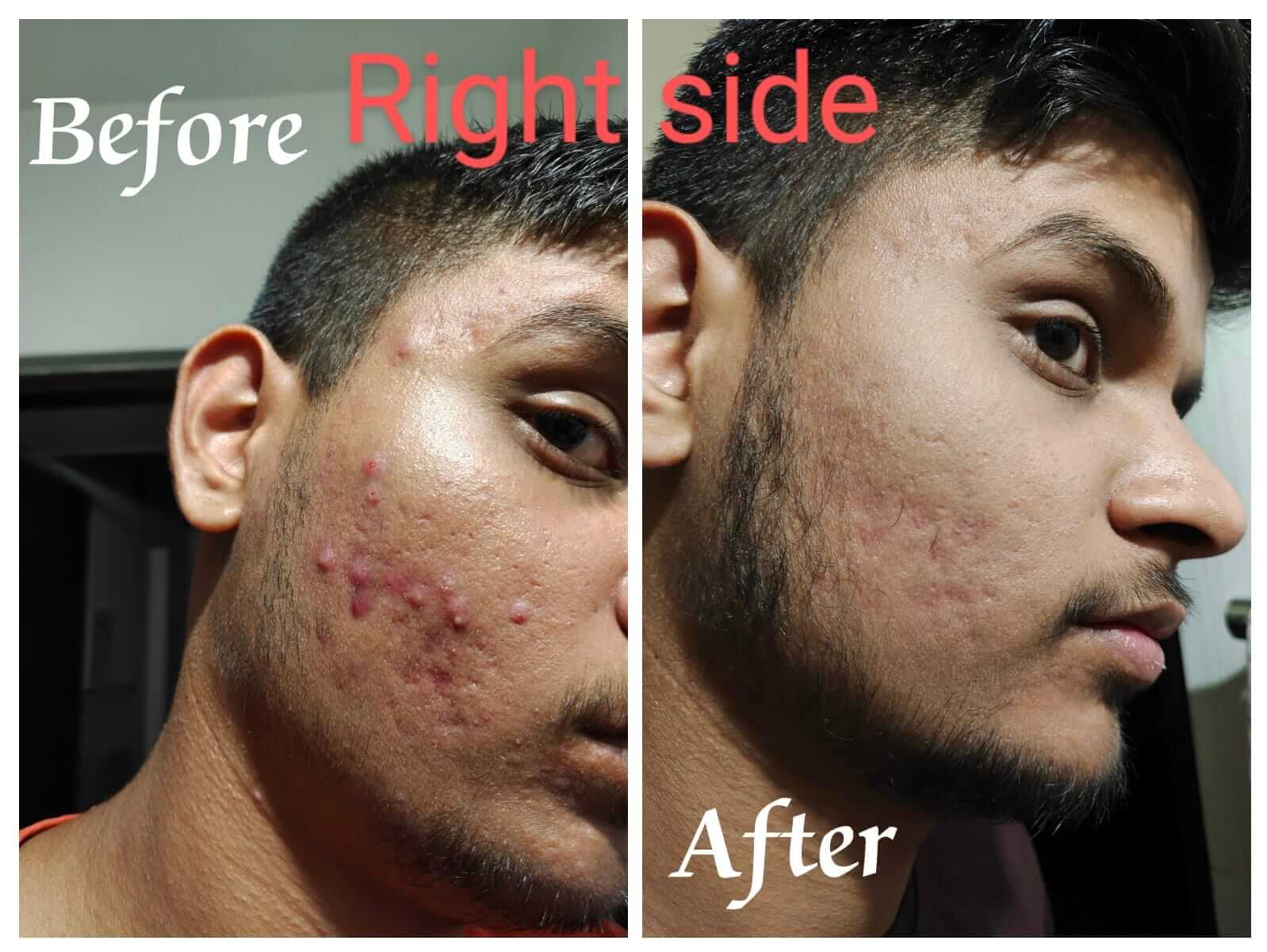 results-theaurraskinclinic-bizknow.in-10