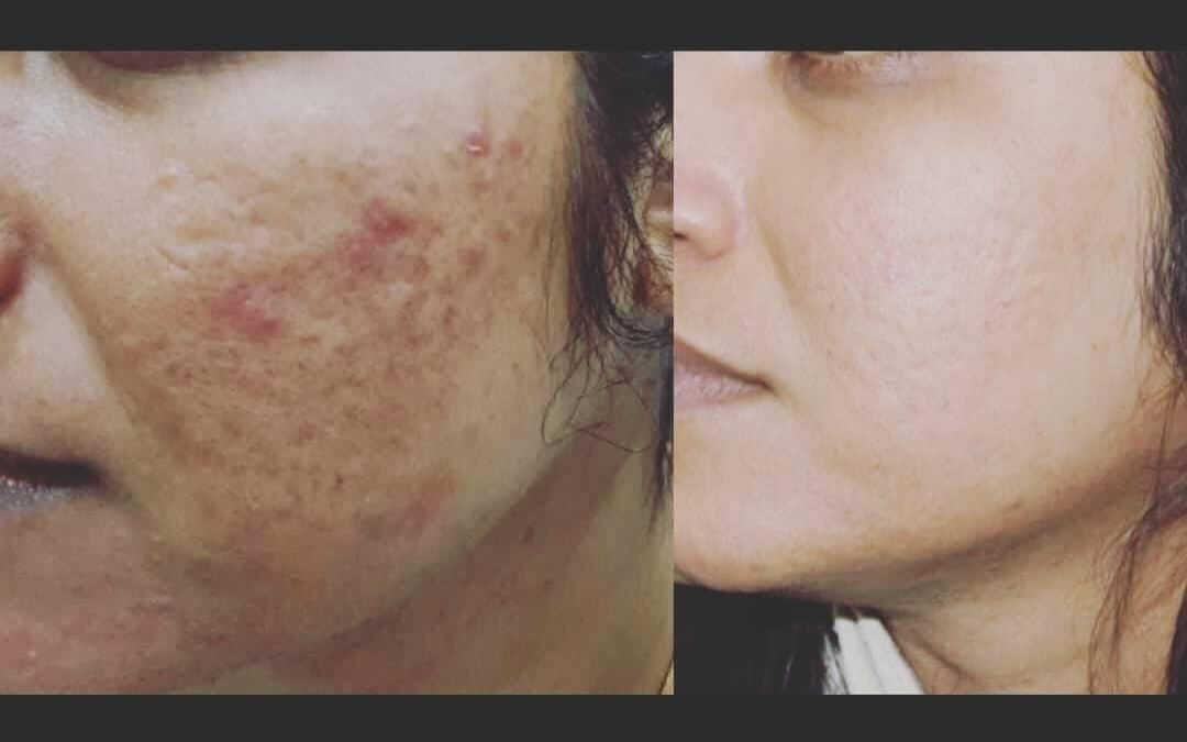 results-theaurraskinclinic-bizknow.in-7